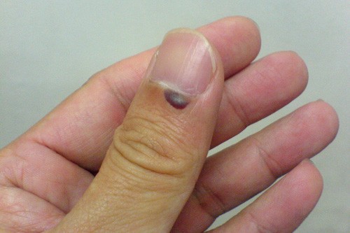 thumb1.jpg