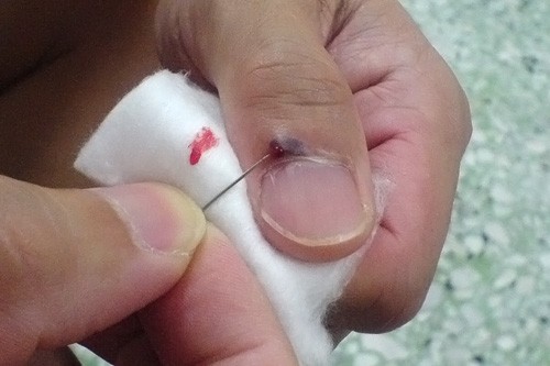 thumb2.jpg